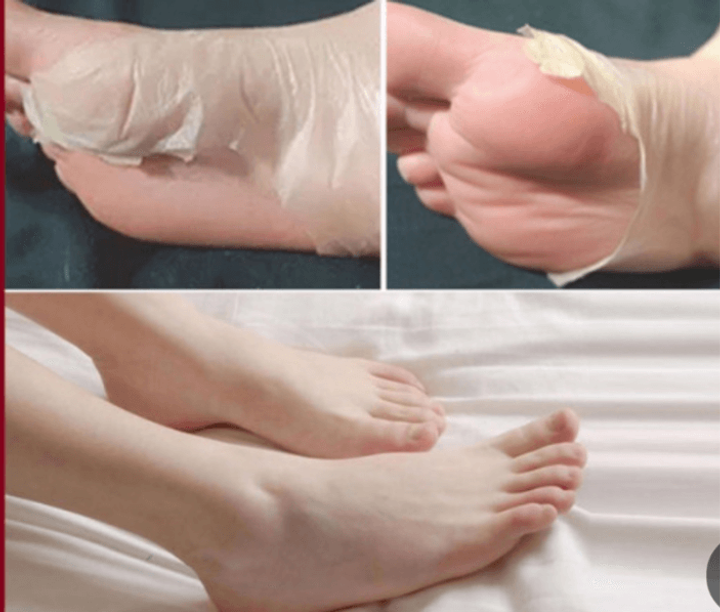 JuzBeauty_JuzBeautyMalaysia_JuzPretty_Authentic_Kbeauty_Malaysia_Skin_Care_Cosmetics_Jbeauty_Australia_Health_Care_Prreti_Baby_Foot_Mask_Peeling_ (1)