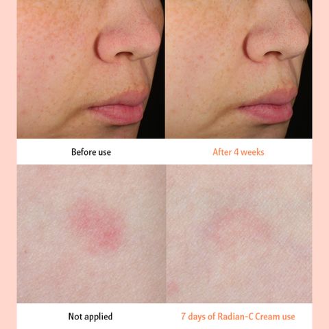 JuzBeauty_JuzBeautyMalaysia_JuzPretty_Authentic_Kbeauty_Malaysia_Skin_Care_Cosmetics_Jbeauty_Australia_Health_Care_LANEIGE_Radian-C_Cream_ (12)