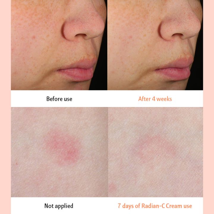 JuzBeauty_JuzBeautyMalaysia_JuzPretty_Authentic_Kbeauty_Malaysia_Skin_Care_Cosmetics_Jbeauty_Australia_Health_Care_LANEIGE_Radian-C_Cream_ (12)