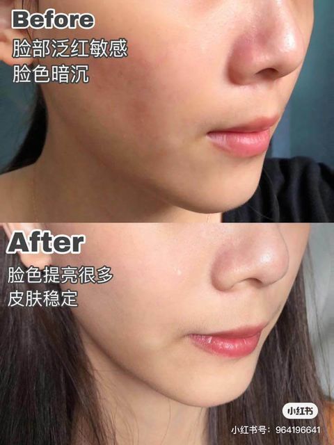 JuzBeauty_JuzBeautyMalaysia_JuzPretty_Authentic_Kbeauty_Malaysia_Skin_Care_Cosmetics_Jbeauty_Australia_Health_Care_korean_streetwear_Dong-A Pharm Melanosa Anti-Oxidants Freckle Cream 1