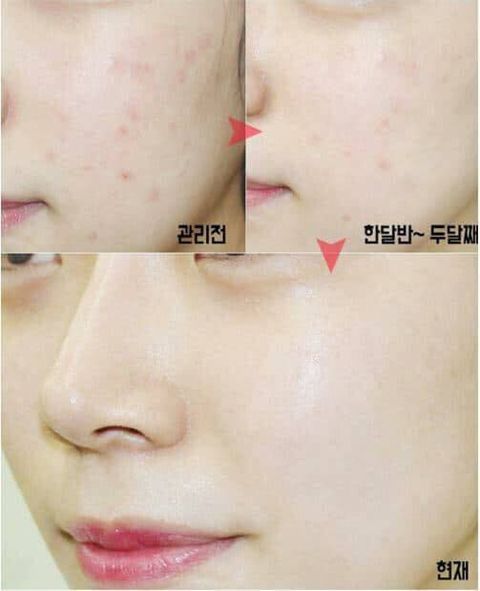 JuzBeauty_JuzBeautyMalaysia_JuzPretty_Authentic_Kbeauty_Malaysia_Skin_Care_Cosmetics_Jbeauty_Australia_Health_Care_korean_streetwear_Isoi Bulgarian Rose Blemish Care Serum 2