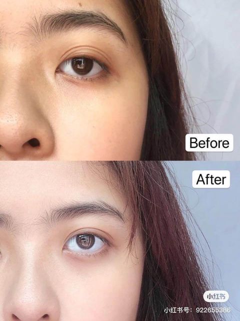JuzBeauty_JuzBeautyMalaysia_JuzPretty_Authentic_Kbeauty_Malaysia_Skin_Care_Cosmetics_Jbeauty_Australia_Health_Care_korean_streetwear_celimax The Real Noni Energy Ampoule 10