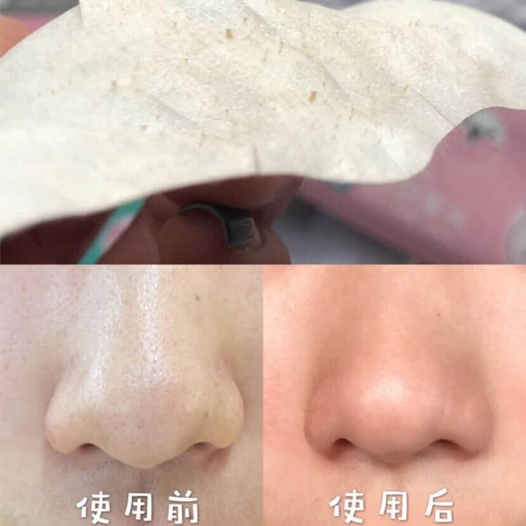 JuzBeauty_JuzBeautyMalaysia_JuzPretty_Authentic_Kbeauty_Malaysia_Skin_Care_Cosmetics_Jbeauty_Health_Care_korean_streetwear_One-days you No More Blackhead Pore Clearing Duo 黑头粉刺导出液6