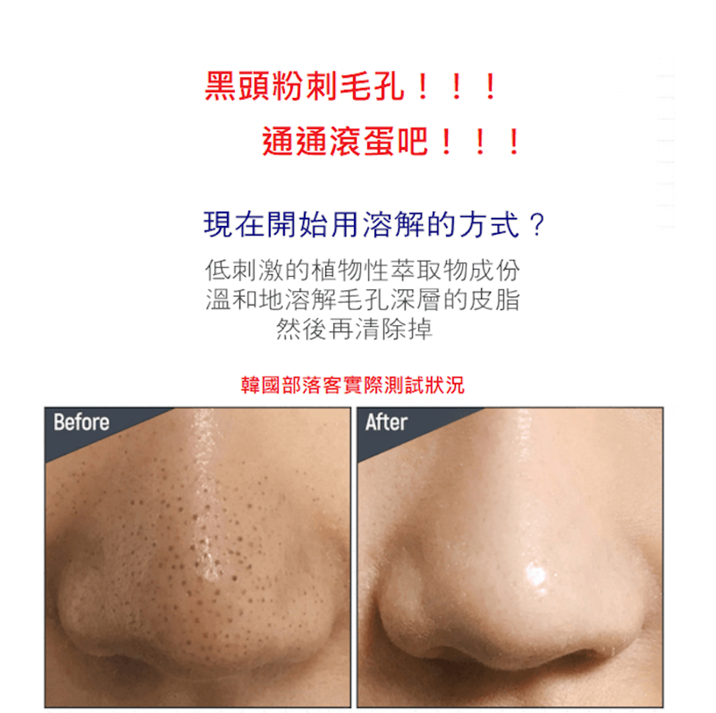 JuzBeauty_JuzBeautyMalaysia_JuzPretty_Authentic_Kbeauty_Malaysia_Skin_Care_Cosmetics_Jbeauty_Health_Care_korean_streetwear_One-days you No More Blackhead Pore Clearing Duo 黑头粉刺导出液4