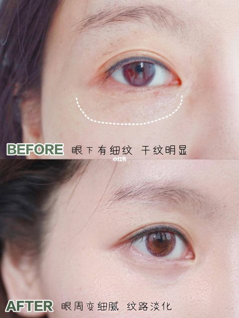 JuzBeauty_JuzBeautyMalaysia_JuzPretty_Authentic_Kbeauty_Malaysia_Skin_Care_Cosmetics_Jbeauty_Health_Care_korean_streetwear_LA MER The Eye Concentrate Cream LAMER 海蓝之谜精华眼霜小绿瓶 1