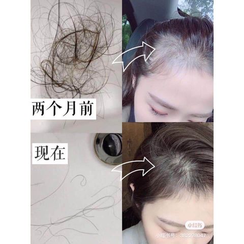 JuzBeauty_JuzBeautyMalaysia_JuzPretty_Authentic_Kbeauty_Malaysia_Skin_Care_Cosmetics_Jbeauty_Health_Care_korean_streetwear_DAYCELL MBA Derma Scalp Hair Volumizer Shampoo 生发洗发水5