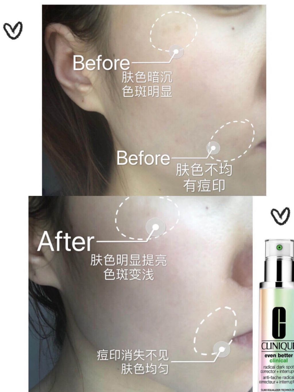 JuzBeauty_JuzBeautyMalaysia_JuzPretty_Authentic_Kbeauty_Malaysia_Skin_Care_Cosmetics_Jbeauty_Health_Care_korean_streetwear_CLINIQUE Even Better Clinical Radical Dark Spot Corrector Interrupter Serum 302 镭射美白淡斑精华8