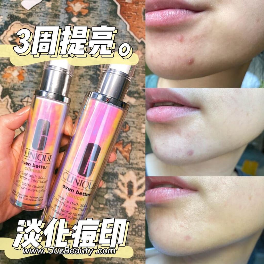 JuzBeauty_JuzBeautyMalaysia_JuzPretty_Authentic_Kbeauty_Malaysia_Skin_Care_Cosmetics_Jbeauty_Health_Care_korean_streetwear_CLINIQUE Even Better Clinical Radical Dark Spot Corrector Interrupter Serum 302 镭射美白淡斑精华13