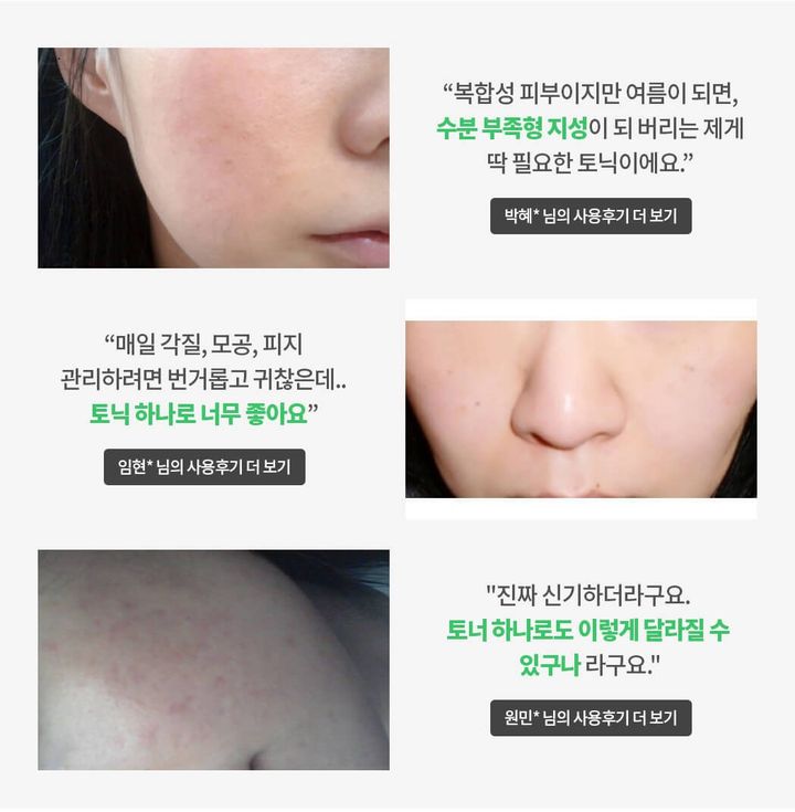 JuzBeauty_JuzBeautyMalaysia_JuzPretty_Authentic_Kbeauty_Malaysia_Skin_Care_Cosmetics_Jbeauty_Health_Care_korean_streetwear_ISOI Pore Tightening Tonic Essence Pore Tonic 毛孔紧致精华水8