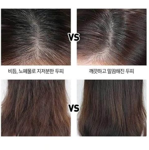 JuzBeauty_JuzBeautyMalaysia_JuzPretty_Authentic_Kbeauty_Malaysia_Skin_Care_Cosmetics_Jbeauty_Health_Care_korean_streetwear_CP-1 Ginger Purifying Shampoo Conditioner 生姜洗发水 护发素3