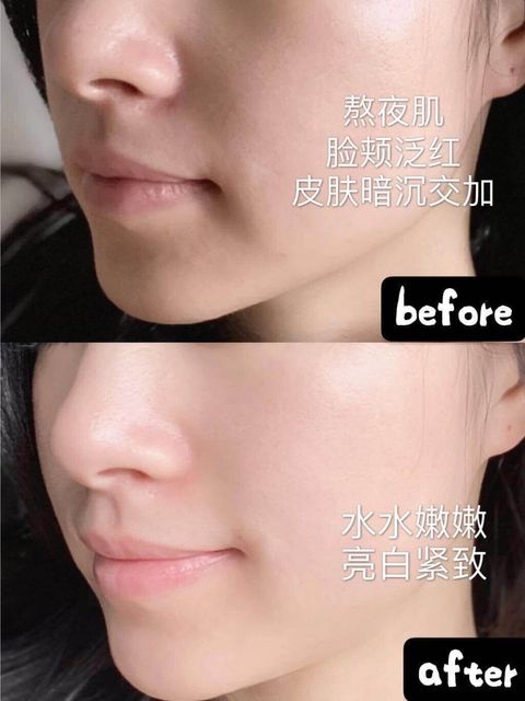 JuzBeauty_JuzBeautyMalaysia_JuzPretty_Authentic_Kbeauty_Malaysia_Skin_Care_Cosmetics_Jbeauty_Health_Care_korean_streetwear_fresh Kombucha Facial Treatment Essence 红茶酵母精华水 1