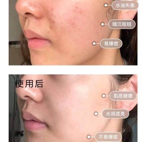 JuzBeauty_JuzBeautyMalaysia_JuzPretty_Authentic_Kbeauty_Malaysia_Skin_Care_Cosmetics_Jbeauty_Health_Care_korean_streetwear_Mamonde Red Energy Recovery Serum 小红瓶再生肌底修护精华11