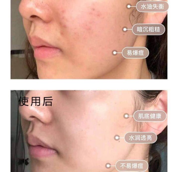 JuzBeauty_JuzBeautyMalaysia_JuzPretty_Authentic_Kbeauty_Malaysia_Skin_Care_Cosmetics_Jbeauty_Health_Care_korean_streetwear_Mamonde Red Energy Recovery Serum 小红瓶再生肌底修护精华11
