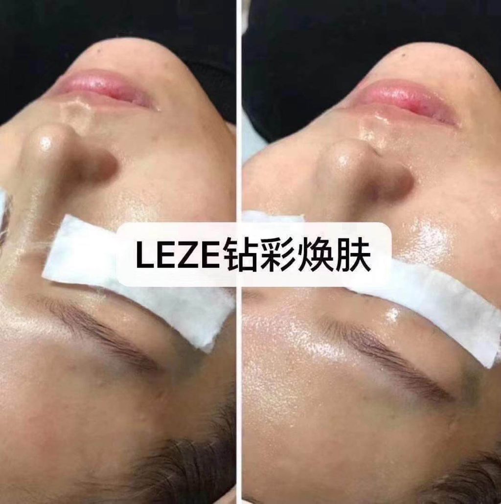 JuzBeauty_JuzBeautyMalaysia_JuzPretty_Authentic_Kbeauty_Malaysia_Skin_Care_Cosmetics_Jbeauty_Health_Care_korean_streetwear_Leze Derma Hydro Kit 钻彩焕肤水光套盒9