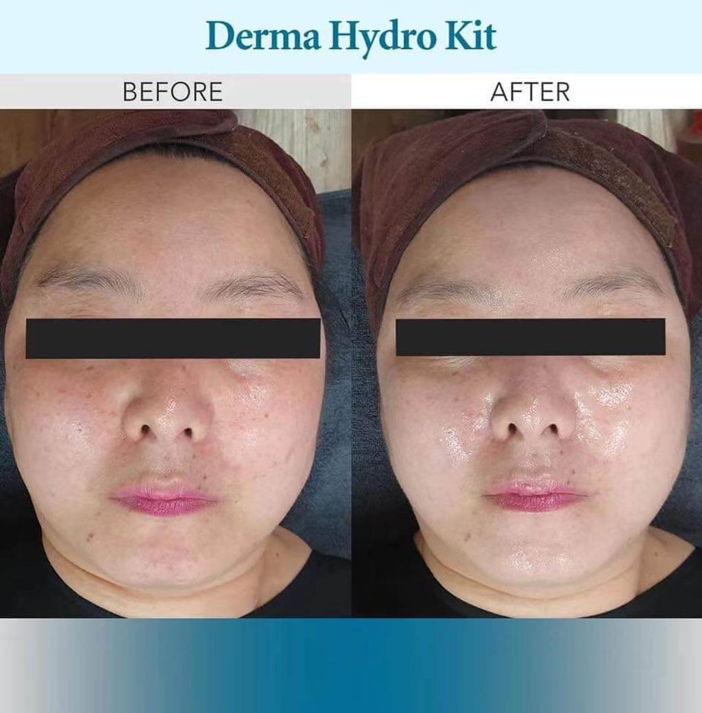 JuzBeauty_JuzBeautyMalaysia_JuzPretty_Authentic_Kbeauty_Malaysia_Skin_Care_Cosmetics_Jbeauty_Health_Care_korean_streetwear_Leze Derma Hydro Kit 钻彩焕肤水光套盒20