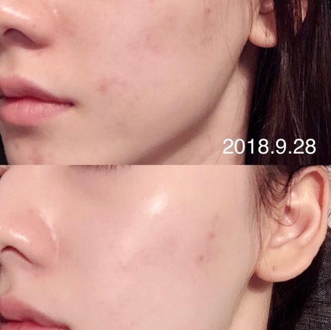 JuzBeauty_JuzBeautyMalaysia_JuzPretty_Authentic_Kbeauty_Malaysia_Skin_Care_Cosmetics_Jbeauty_Health_Care_korean_streetwear_LANCOME Advanced Génifique Youth Activating Concentrate Serum 小黑瓶肌底精华第二代1
