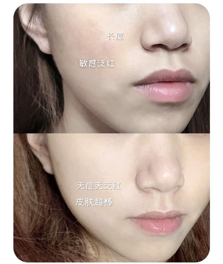JuzBeauty_JuzBeautyMalaysia_JuzPretty_Authentic_Kbeauty_Malaysia_Skin_Care_Cosmetics_Jbeauty_Health_Care_korean_streetwear_UNNY CLUB Oil Control Hydrating Set 控油清爽水乳套盒13