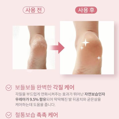 JuzBeauty_JuzBeautyMalaysia_JuzPretty_Authentic_Kbeauty_Malaysia_Skin_Care_Cosmetics_Jbeauty_Health_Care_korean_streetwear_Prreti Urea Moisturizing Foot Cream 尿素保湿足霜3