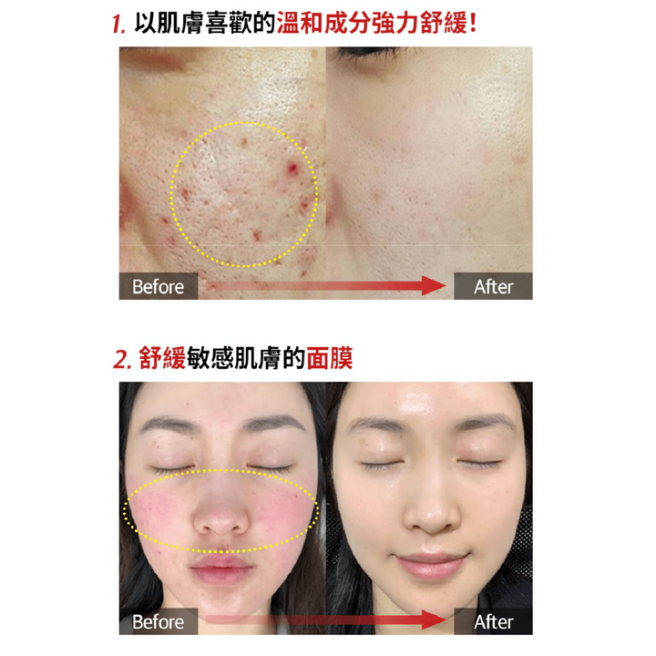JuzBeauty_JuzBeautyMalaysia_JuzPretty_Authentic_Kbeauty_Malaysia_Skin_Care_Cosmetics_Jbeauty_Health_Care_korean_streetwear_MEDI-PEEL Cica-Nol Ampoule Mask MEDIPEEL 积雪草舒缓面膜3