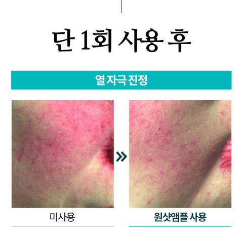 JuzBeauty_JuzBeautyMalaysia_JuzPretty_Authentic_Kbeauty_Malaysia_Skin_Care_Cosmetics_Jbeauty_Health_Care_korean_streetwear_US_REJURAN Derma Healer Moisture Treatment Ampoule 保湿修护安瓶套盒3