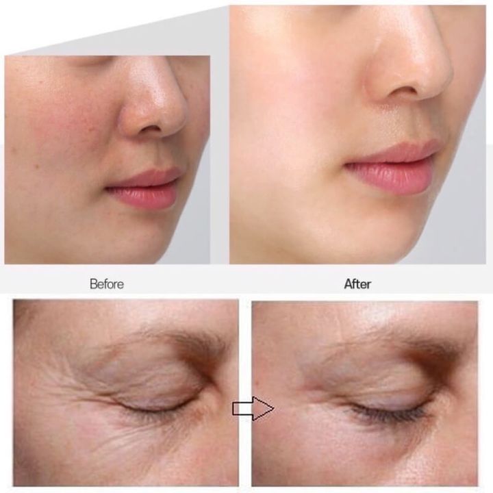 JuzBeauty_JuzBeautyMalaysia_JuzPretty_Authentic_Kbeauty_Malaysia_Skin_Care_Cosmetics_Jbeauty_Health_Care_korean_streetwear_US_MEDI-PEEL Bor-Tox Multi Care Kit MEDIPEEL 抗老肉毒多效护理套盒3