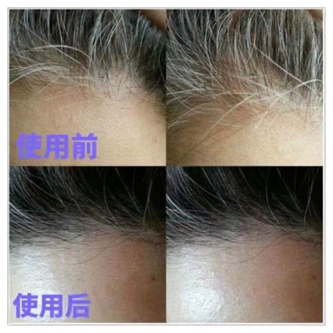 JuzBeauty_JuzBeautyMalaysia_JuzPretty_Authentic_Kbeauty_Malaysia_Skin_Care_Cosmetics_Jbeauty_Health_Care_korean_streetwear_US_DAYCELL MBA MoBalA Derma Scalp Intensive Black Turn Ampoule 生发+黑发滚珠精华2