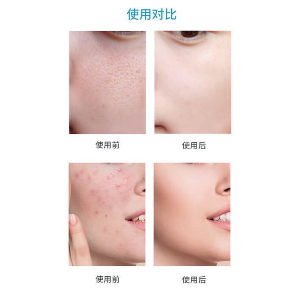 JuzBeauty_JuzBeautyMalaysia_JuzPretty_Authentic_Kbeauty_Malaysia_Skin_Care_Cosmetics_Jbeauty_Health_Care_korean_streetwear_STRIDEX Salicylic Acid Acne Pad 水杨酸棉片12