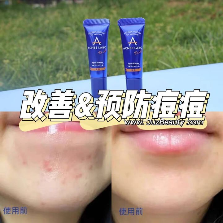 JuzBeauty_JuzBeautyMalaysia_JuzPretty_Authentic_Kbeauty_Malaysia_Skin_Care_Cosmetics_Jbeauty_Health_Care_korean_streetwear_ACNES LABO Spots Cream 祛痘膏1