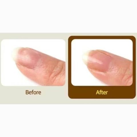 JuzBeauty_JuzBeautyMalaysia_JuzPretty_Authentic_Kbeauty_Malaysia_Skin_Care_Cosmetics_Jbeauty_Health_Care_korean_streetwear_MEDIPEEL Rx. Oriental Foot and Nail Ampoule MEDI-PEEL 强韧指甲修护精华2