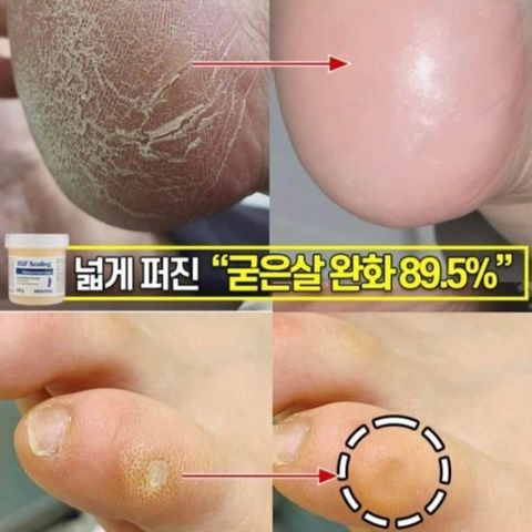 JuzBeauty_JuzBeautyMalaysia_JuzPretty_Authentic_Kbeauty_Malaysia_Skin_Care_Cosmetics_Jbeauty_Health_Care_korean_streetwear_MEDIPEEL EGF Scaling Moisture Foot Cream MEDI-PEEL EGF去角质修护足霜4