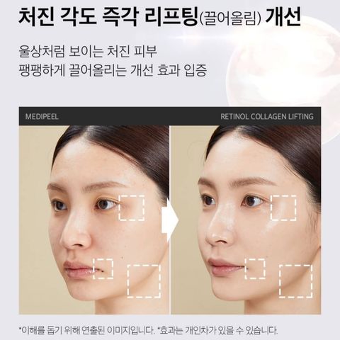JuzBeauty_JuzBeautyMalaysia_JuzPretty_Authentic_Kbeauty_Malaysia_Skin_Care_Cosmetics_Jbeauty_Health_Care_korean_streetwear_MEDIPEEL Retinol Collagen Lifting Cream MEDI-PEEL 胶原蛋白提拉面霜 6