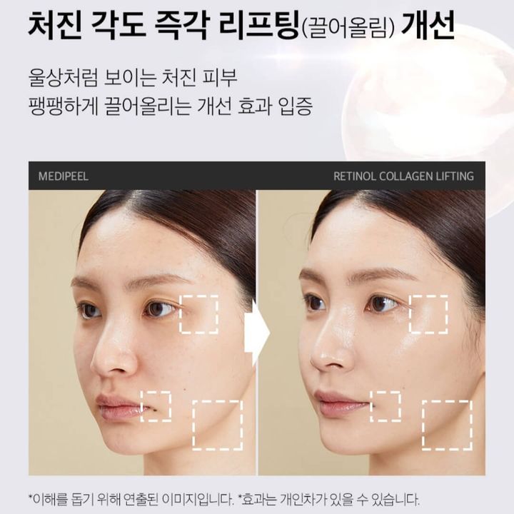 JuzBeauty_JuzBeautyMalaysia_JuzPretty_Authentic_Kbeauty_Malaysia_Skin_Care_Cosmetics_Jbeauty_Health_Care_korean_streetwear_MEDIPEEL Retinol Collagen Lifting Cream MEDI-PEEL 胶原蛋白提拉面霜 6