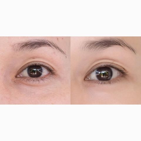 JuzBeauty_JuzBeautyMalaysia_JuzPretty_Authentic_Kbeauty_Malaysia_Skin_Care_Cosmetics_Jbeauty_Health_Care_korean_streetwear_JM Solution Cure In Hyal-Biome Colla-Biome Eye Patch JMSolution 深层补水蓝色 紧致护理粉色精华眼膜2