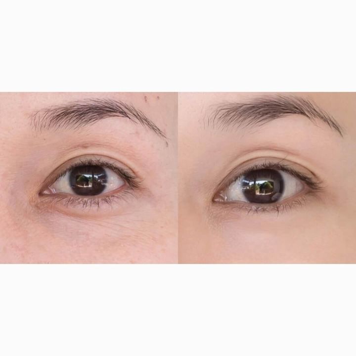 JuzBeauty_JuzBeautyMalaysia_JuzPretty_Authentic_Kbeauty_Malaysia_Skin_Care_Cosmetics_Jbeauty_Health_Care_korean_streetwear_JM Solution Cure In Hyal-Biome Colla-Biome Eye Patch JMSolution 深层补水蓝色 紧致护理粉色精华眼膜2