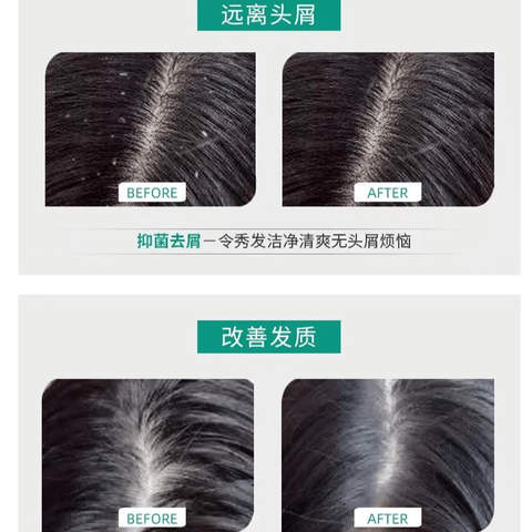 JuzBeauty-JuzBeautyMalaysia-JuzPretty-Authentic-Kbeauty-Malaysia-Skin-Care-Cosmetics-Jbeauty-Health-Care-korean-streetwear-LION Anti-Dandruff Shampoo 狮王去头屑洗发水6