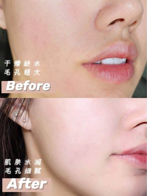 JuzBeauty_JuzBeautyMalaysia_Authentic_Kbeauty_AHC_Premium_EX_Hydra_B5_Toner_Lotion_B5_玻尿酸水乳3