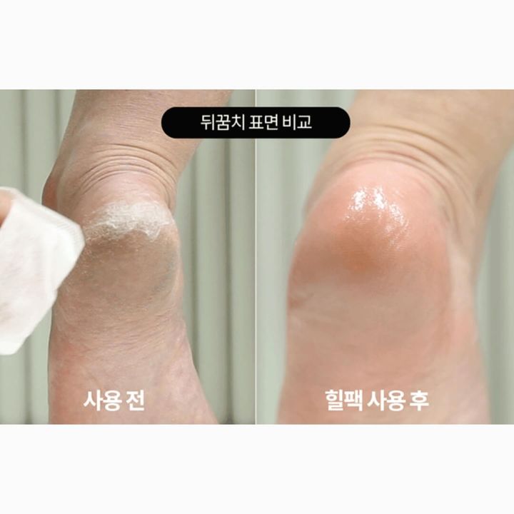 JuzBeauty-JuzBeautyMalaysia-JuzPretty-Authentic-Kbeauty-Malaysia-Skin-Care-Cosmetics-Jbeauty-Health-Care-korean-streetwear-F3 SYSTEMS Heel Moisturizing Mask Pack 后脚跟润肤足贴1