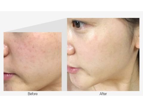 JuzBeauty-JuzBeautyMalaysia-JuzPretty-Authentic-Kbeauty-Malaysia-Skin-Care-Cosmetics-Jbeauty-Health-Care-korean-streetwear-MEDI-PEEL Customize Whitening Toning 9 Essence MEDIPEEL 抗氧美白乳状精华6