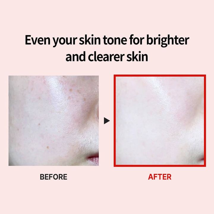 JuzBeauty-JuzBeautyMalaysia-JuzPretty-Authentic-Kbeauty-Malaysia-Skin-Care-Cosmetics-Jbeauty-Health-Care-korean-streetwear-MEDI-PEEL Melanon X Ampoule MEDIPEEL MELANON X 美白淡斑7秒安瓶 6
