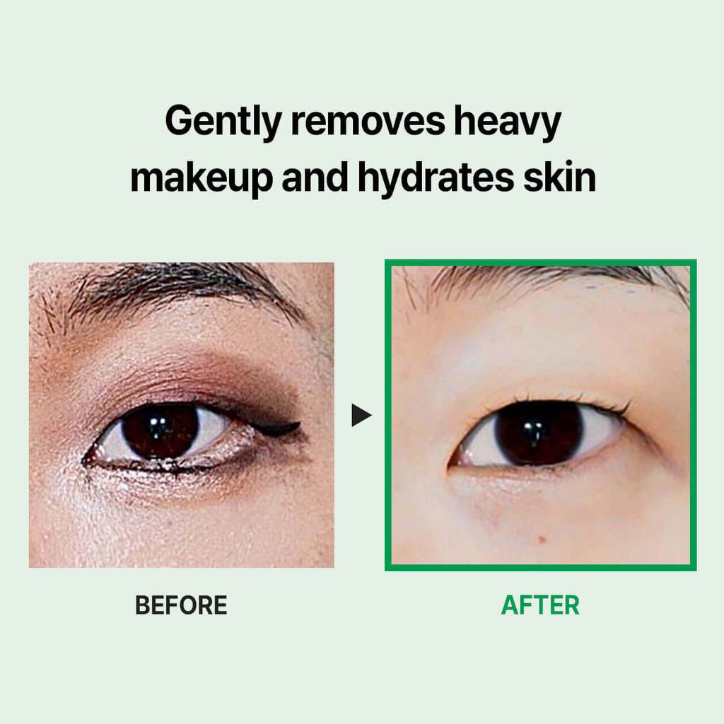 JuzBeauty-JuzBeautyMalaysia-JuzPretty-Authentic-Kbeauty-Malaysia-Skin-Care-Cosmetics-Jbeauty-Health-Care-korean-streetwear-MEDI-PEEL Phyto Cicanol B5 AHA BHA Vitamin Calming Micellar Cleansing Water MEDIPEEL 镇静胶束洁面卸妆水2