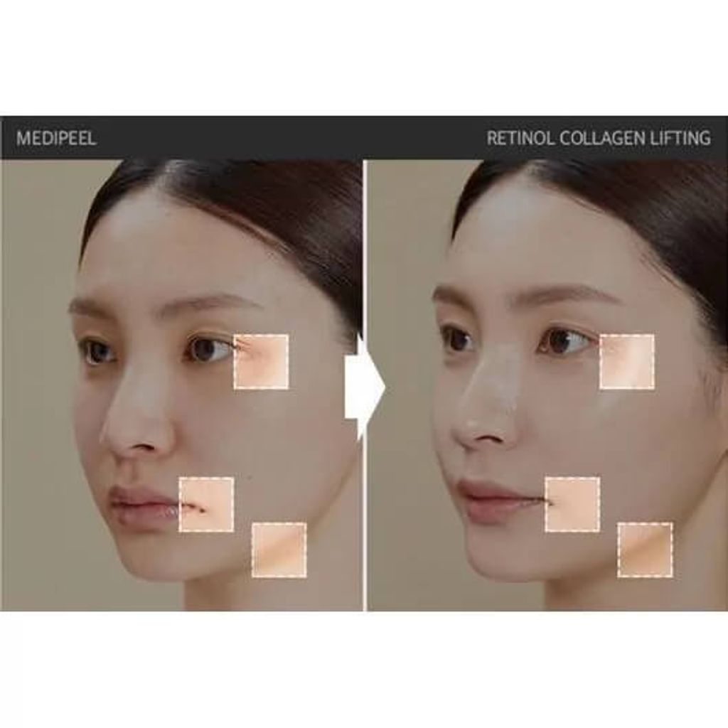 JuzBeauty-JuzBeautyMalaysia-JuzPretty-Authentic-Kbeauty-Malaysia-Skin-Care-Cosmetics-Jbeauty-Health-Care-korean-streetwear-MEDIPEEL Retinol Collagen Lifting Ampoule MEDI-PEEL 胶原蛋白提拉安瓶7