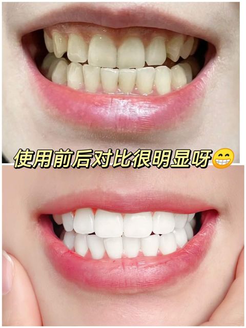 JuzBeauty-JuzBeautyMalaysia-JuzPretty-Authentic-Kbeauty-Malaysia-Skin-Care-Cosmetics-Jbeauty-Health-Care-korean-streetwear-VUSSEN 28 Extra Whitening Toothpaste 美白牙膏4
