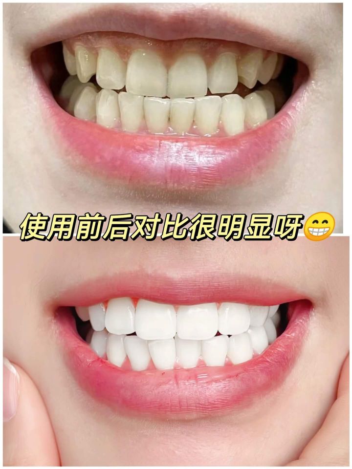 JuzBeauty-JuzBeautyMalaysia-JuzPretty-Authentic-Kbeauty-Malaysia-Skin-Care-Cosmetics-Jbeauty-Health-Care-korean-streetwear-VUSSEN 28 Extra Whitening Toothpaste 美白牙膏4