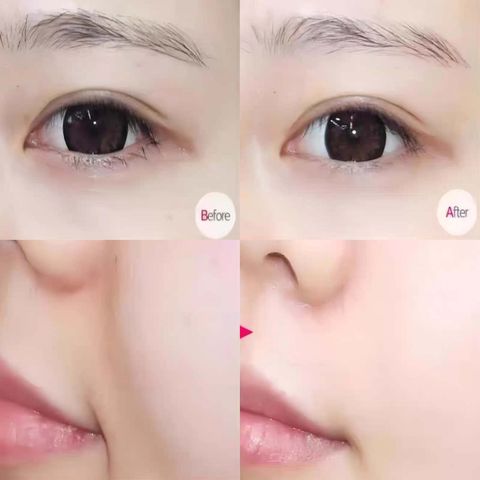 JuzBeauty-JuzBeautyMalaysia-JuzPretty-Authentic-Kbeauty-Malaysia-Skin-Care-Cosmetics-Jbeauty-Health-Care-korean-streetwear-REJURAN Healing Eye Gel 眼周修复凝胶3