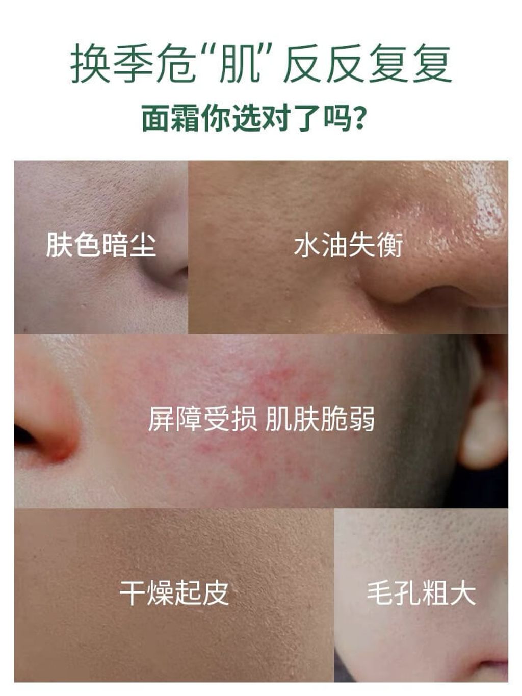 JuzBeauty-JuzBeautyMalaysia-JuzPretty-Authentic-Kbeauty-Malaysia-Skin-Care-Cosmetics-Jbeauty-Health-Care-korean-streetwear-Olive Young Dr G Red Blemish Clear Soothing Cream DRG 修复保湿奶冻面霜4