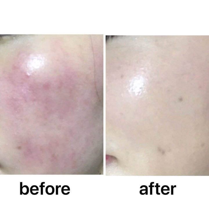 JuzBeauty-JuzBeautyMalaysia-JuzPretty-Authentic-Kbeauty-Malaysia-Skin-Care-Cosmetics-Jbeauty-Health-Care-korean-streetwear-Olive Young Dr G Red Blemish Clear Soothing Toner DRG 修复舒缓爽肤水9