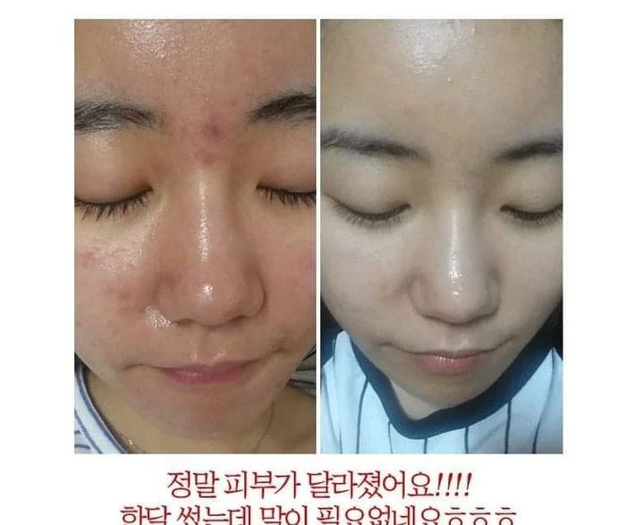 JuzBeauty-JuzBeautyMalaysia-JuzPretty-Authentic-Kbeauty-Malaysia-Skin-Care-Cosmetics-Jbeauty-Health-Care-korean-streetwear-Olive Young MANYO FACTORY Galactomy Niacin Essence 酵母菌烟酰胺美白精华 小白瓶 12