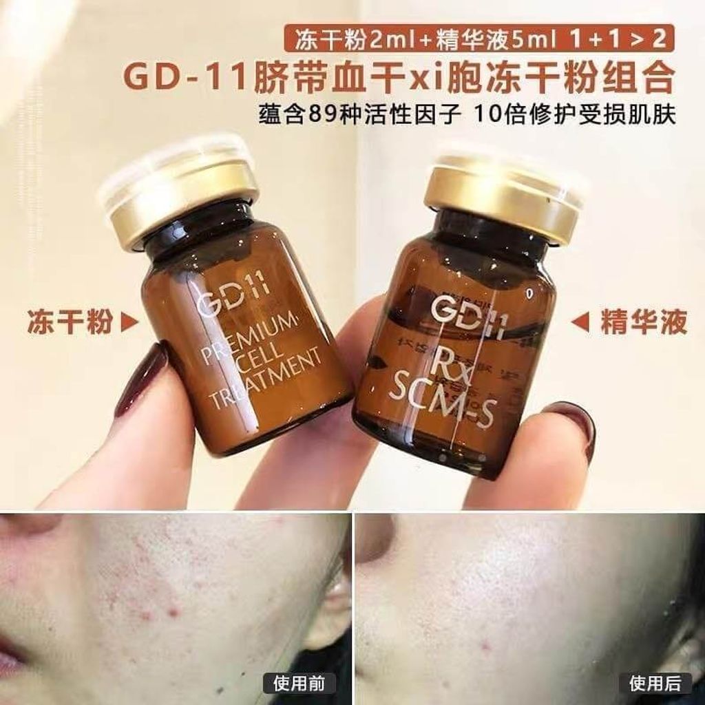 JuzBeauty-JuzBeautyMalaysia-JuzPretty-Authentic-Kbeauty-Malaysia-Skin-Care-Cosmetics-Jbeauty-Health-Care-korean-streetwear-GD11 Rx SCM Program 冻干粉套组3