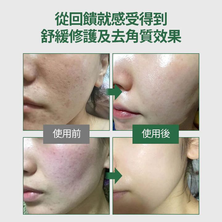 JuzBeauty-JuzBeautyMalaysia-JuzPretty-Authentic-Kbeauty-Malaysia-Skin-Care-Cosmetics-Jbeauty-Health-Care-korean-streetwear-Olive Young MEDIPEEL PHYTO CICA-NOL B5 AHA BHA Vitamin Calming Toner MEDI-PEEL 植萃积雪草B5双酸亮白化妆水 13