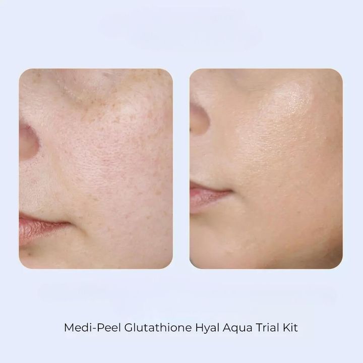 JuzBeauty-JuzBeautyMalaysia-JuzPretty-Authentic-Kbeauty-Malaysia-Skin-Care-Cosmetics-Jbeauty-Health-Care-korean-streetwear-Olive Young MEDI-PEEL Glutathione Hyal Aqua Trial Kit MEDIPEEL 谷胱甘肽玻尿酸旅行套装3